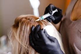 non surgical hair replacement toronto